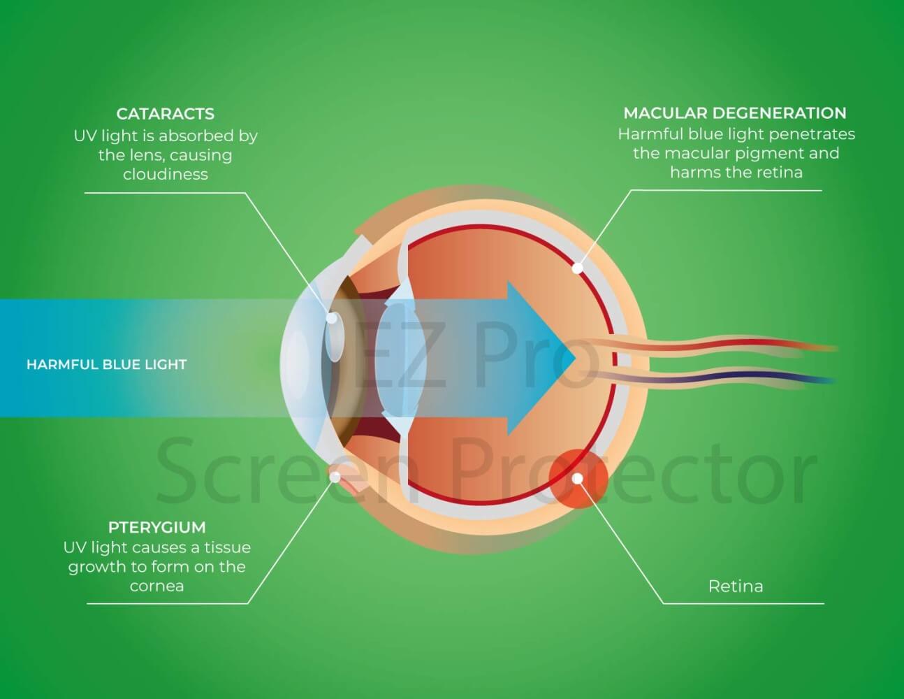 Is dark mode bad for astigmatism